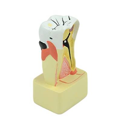Praktisches Pathologie Zahnmodell 4 Parodontalanalyse Für Den Zahnarztunterricht Zahnmedizinklinik Kinderpathologie Zahnmodell Für Den Unterricht Von Kinderzahnärzten Patientenausbildungsstudenten von blispring