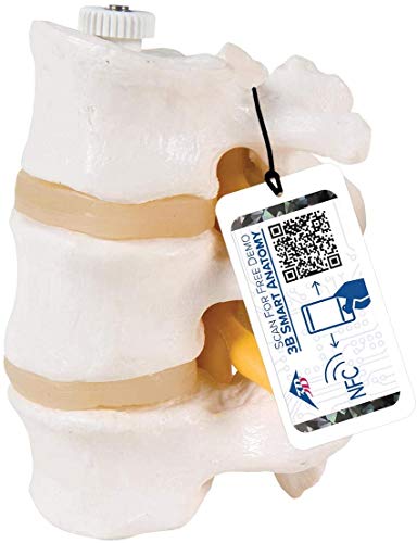 3B Scientific A76/8 3 Lendenwirbel, flexibel montiert + kostenlose Anatomie App - 3B Smart Anatomy 3B Scientific A76/8 3 Lendenwirbel, flexibel montiert + kostenlose Anatomie App - 3B Smart Anatomy von 3B Scientific