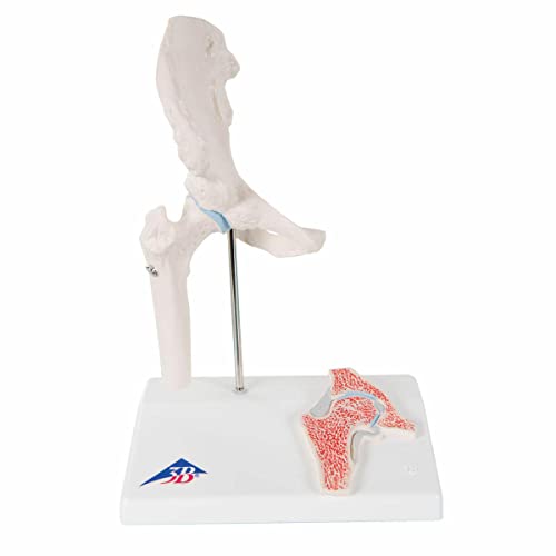 3B Scientific A84/1 Mini-Hüftgelenk mit Querschnitt + kostenlose Anatomie App - 3B Smart Anatomy 3B Scientific A84/1 Mini-Hüftgelenk mit Querschnitt + kostenlose Anatomie App - 3B Smart Anatomy von 3B Scientific