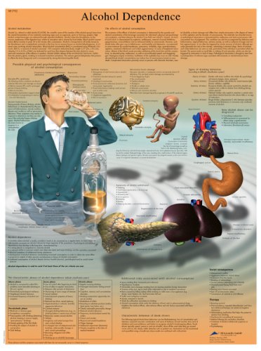 3B Scientific Alkohol Abhängigkeit Diagramm, laminated, 1 3B Scientific Alkohol Abhängigkeit Diagramm, laminated, 1 von 3B Scientific