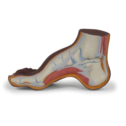 3B Scientific Fußmodell Hohlfuß (Pes cavus), dunkle Hautfarbe - 3B Smart Anatomy von 3B Scientific