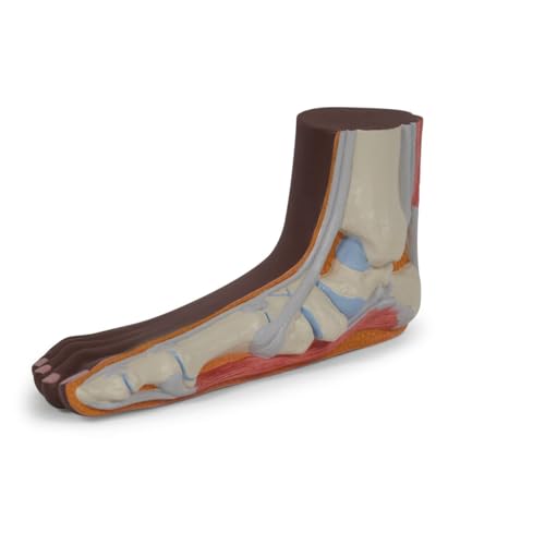 3B Scientific Fußmodell Plattfuß (Pes planus), dunkle Hautfarbe - 3B Smart Anatomy von 3B Scientific