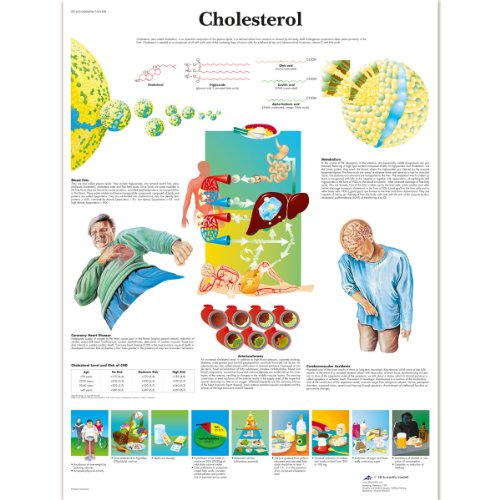 3B Scientific Human Anatomy - Cholesterin-Diagramm, laminierte Version (in englischer Sprache) von 3B Scientific