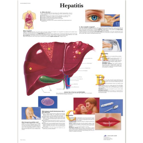 3B Scientific Human Anatomy- Hepatitis-Diagramm, laminierte Version von 3B Scientific