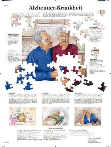 3B Scientific Lehrtafel - Alzheimer-Krankheit von 3B Scientific