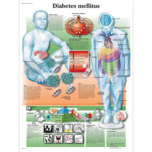 3B Scientific Lehrtafel Diabetes mellitus, unlaminated von 3B Scientific