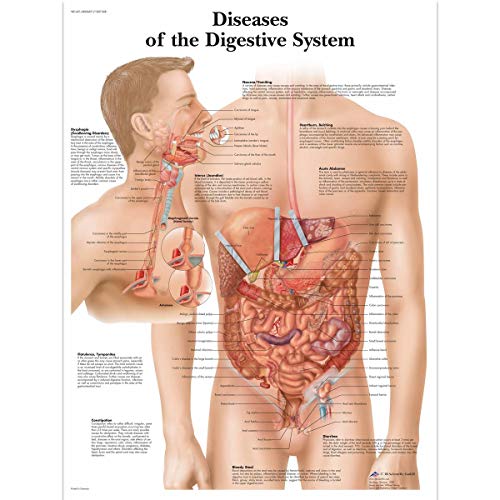 3B Scientific Lehrtafel Erkrankungen des Verdauungssystems, laminiert, 1 3B Scientific Lehrtafel Erkrankungen des Verdauungssystems, laminiert, 1 von 3B Scientific