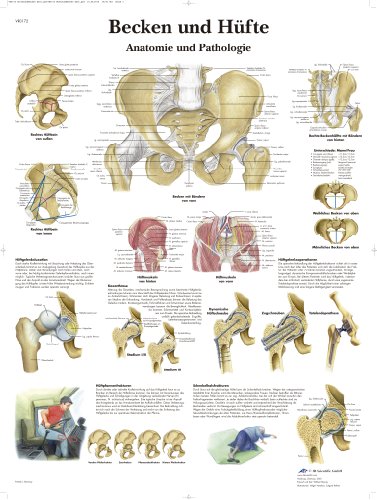 3B Scientific Lehrtafel laminiert - Becken und Hüfte - Anatomie und Pathologie von 3B Scientific