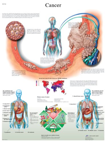 3B Scientific Lehrtaffel laminiert - Cancer - Englisch von 3B Scientific