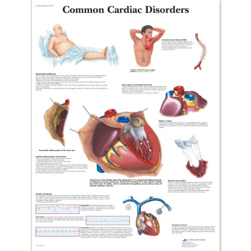 3B Scientific Lehrtaffel laminiert - Common Cardiac Disorders - Englisch von 3B Scientific