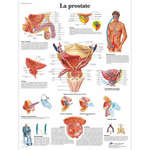 3B Scientific Lehrtaffel laminiert - La prostate - Französisch von 3B Scientific
