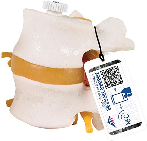 3B Scientific Menschliche Anatomie - 2 Lendenwirbel mit Bandscheibenvorfall, elastisch montiert + kostenlose Anatomie App - 3B Smart Anatomy von 3B Scientific