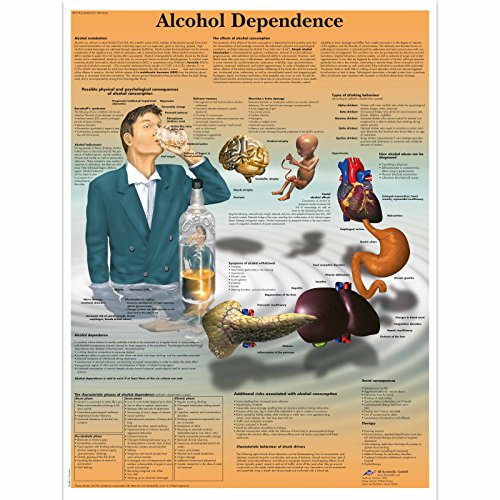 3B Scientific Menschliche Anatomie - Alkoholabhängigkeitsposter, Englisch, Papierversion von 3B Scientific