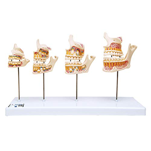 3B Scientific Menschliche Anatomie - Gebissentwicklung + kostenlose Anatomie App - 3B Smart Anatomy 3B Scientific Menschliche Anatomie - Gebissentwicklung + kostenlose Anatomie App - 3B Smart Anatomy von 3B Scientific