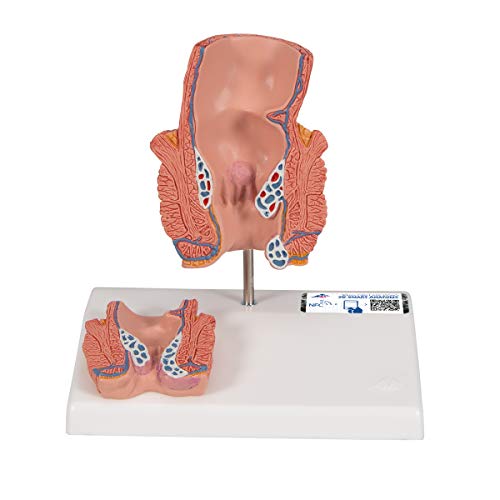 3B Scientific Menschliche Anatomie - Hämorrhoidenmodell + kostenlose Anatomie App - 3B Smart Anatomy 3B Scientific Menschliche Anatomie - Hämorrhoidenmodell + kostenlose Anatomie App - 3B Smart Anatomy von 3B Scientific