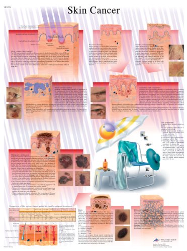 3B Scientific Menschliche Anatomie – Hautkrebs-Diagramm, laminierte Version 3B Scientific Menschliche Anatomie – Hautkrebs-Diagramm, laminierte Version von 3B Scientific