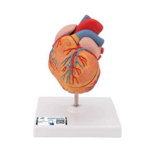 3B Scientific Menschliche Anatomie - Klassik-Herzmodell mit linksventrikulärer Hypertrophie (LVH), 2-teilig + kostenlose Anatomie App - 3B Smart Anatomy, G04 von 3B Scientific