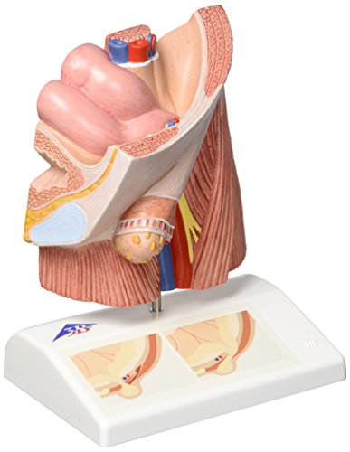 3B Scientific Menschliche Anatomie - Leistenbruchmodell + kostenlose Anatomie App - 3B Smart Anatomy von 3B Scientific