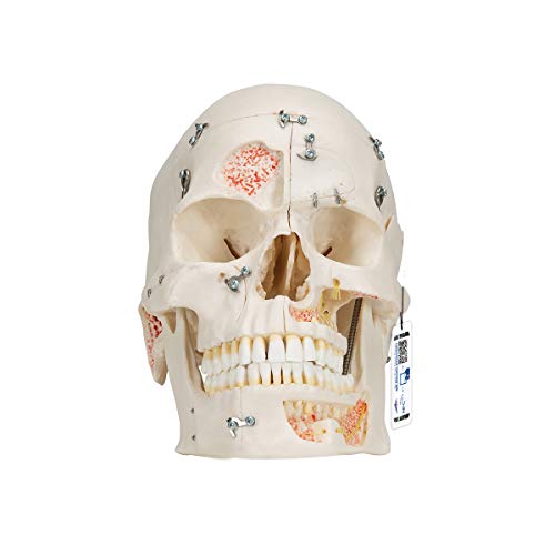 3B Scientific Menschliche Anatomie - Luxus-Demonstrationsschädelmodell, 10-teilig + kostenlose Anatomie App - 3B Smart Anatomy, A27 3B Scientific Menschliche Anatomie - Luxus-Demonstrationsschädelmodell, 10-teilig + kostenlose Anatomie App - 3B Smart Anatomy, A27 von 3B Scientific