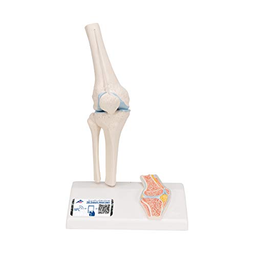 3B Scientific Menschliche Anatomie - Mini-Kniegelenkmodell mit Querschnitt + kostenlose Anatomie App - 3B Smart Anatomy, A85/1 3B Scientific Menschliche Anatomie - Mini-Kniegelenkmodell mit Querschnitt + kostenlose Anatomie App - 3B Smart Anatomy, A85/1 von 3B Scientific