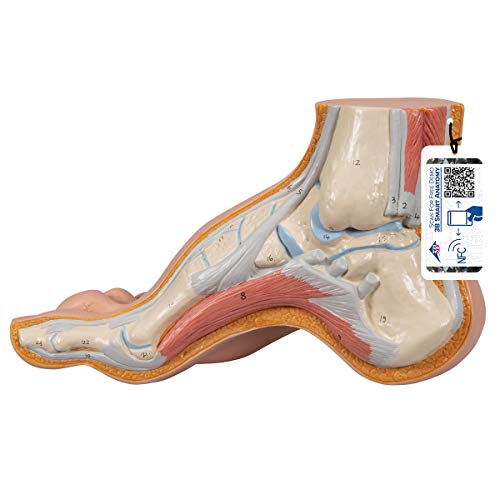 3B Scientific Menschliche Anatomie - Modell - Hohlfuß (Pes cavus) + kostenlose Anatomie App - 3B Smart Anatomy, M32 von 3B Scientific