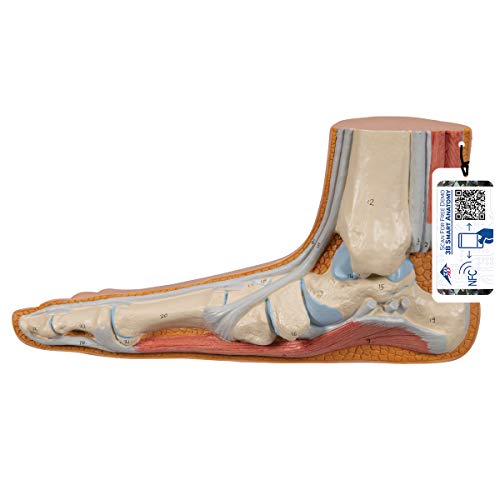 3B Scientific Menschliche Anatomie - Modell - Plattfuß (Pes planus) + kostenlose Anatomie App - 3B Smart Anatomy von 3B Scientific