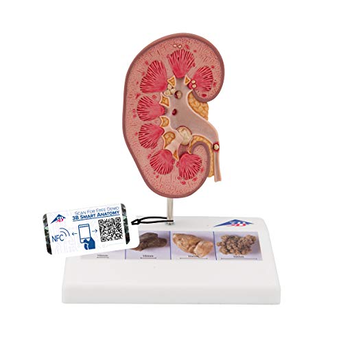 3B Scientific Menschliche Anatomie - Nierensteinmodell + kostenlose Anatomie App - 3B Smart Anatomy, K29 3B Scientific Menschliche Anatomie - Nierensteinmodell + kostenlose Anatomie App - 3B Smart Anatomy, K29 von 3B Scientific
