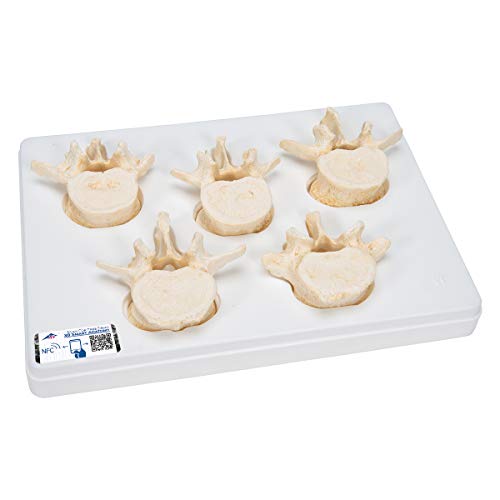 3B Scientific Menschliche Anatomie - Set mit 5 Lendenwirbeln + kostenlose Anatomie App - 3B Smart Anatomy 3B Scientific Menschliche Anatomie - Set mit 5 Lendenwirbeln + kostenlose Anatomie App - 3B Smart Anatomy von 3B Scientific