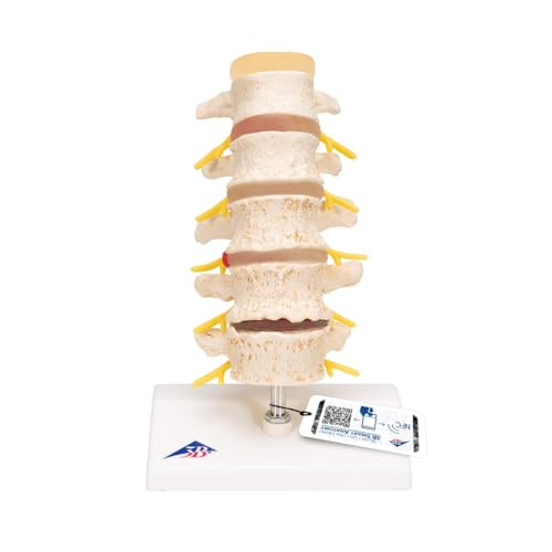 3B Scientific Menschliche Anatomie - Stadien des Bandscheibenvorfalls und der Wirbeldegeneration + kostenlose Anatomie App - 3B Smart Anatomy, A795 3B Scientific Menschliche Anatomie - Stadien des Bandscheibenvorfalls und der Wirbeldegeneration + kostenlose Anatomie App - 3B Smart Anatomy, A795 von 3B Scientific