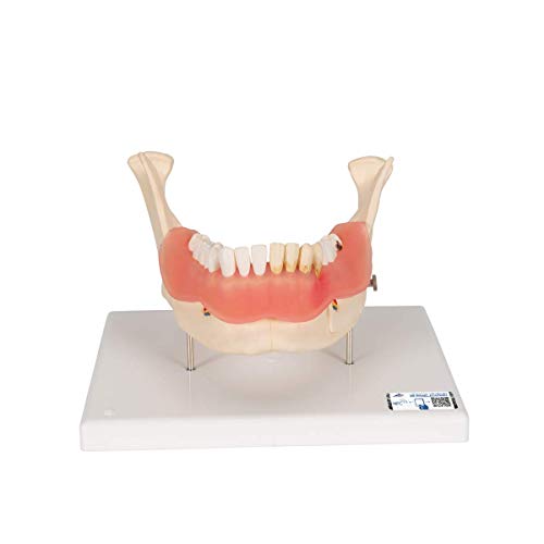 3B Scientific Menschliche Anatomie - Zahnerkrankungsmodell, 2-fach vergrößert, 21-teilig + kostenlose Anatomie App - 3B Smart Anatomy 3B Scientific Menschliche Anatomie - Zahnerkrankungsmodell, 2-fach vergrößert, 21-teilig + kostenlose Anatomie App - 3B Smart Anatomy von 3B Scientific