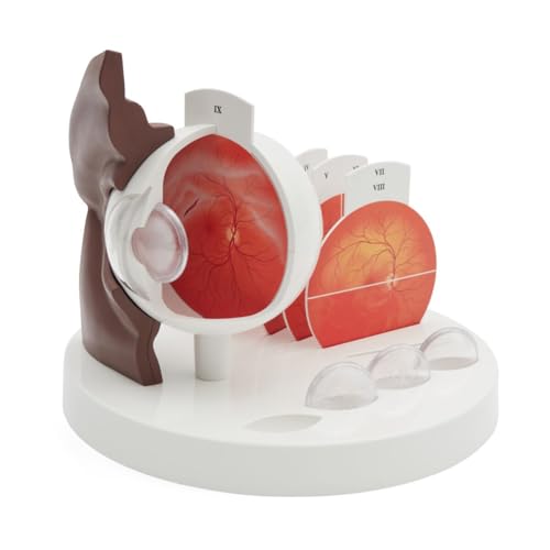 3B Scientific Pathologisches Augenmodell, dunkle Hautfarbe - 3B Smart Anatomy 3B Scientific Pathologisches Augenmodell, dunkle Hautfarbe - 3B Smart Anatomy von 3B Scientific