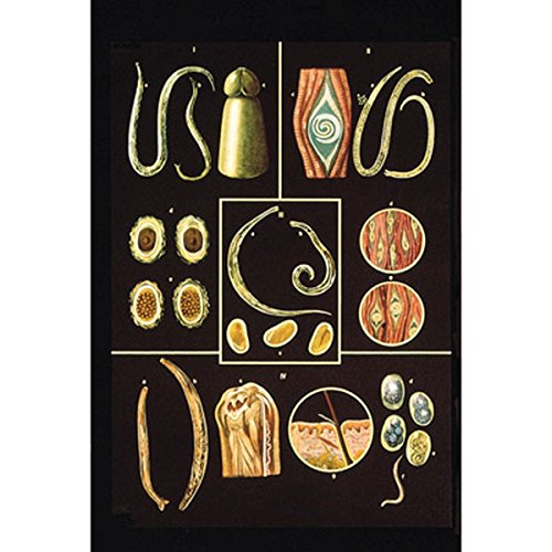 3B Scientific V2028M Lehrtafel, Darmparasiten II von 3B Scientific