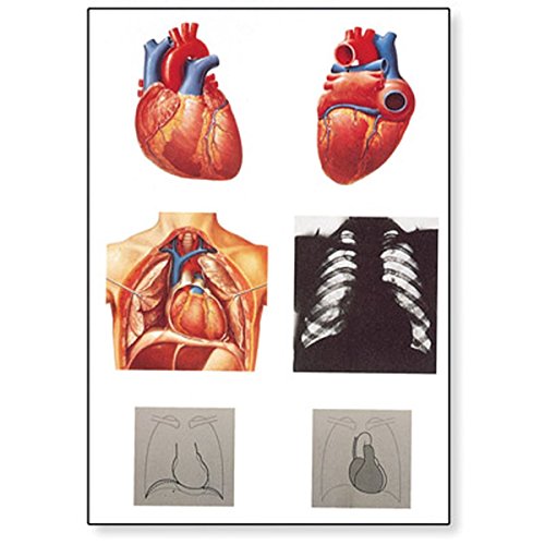 3B Scientific V2053M Lehrtafel, Das Herz I, Anatomie von 3B Scientific