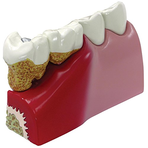 GPI Anatomicals 2860 Zähne Modell von 3B Scientific
