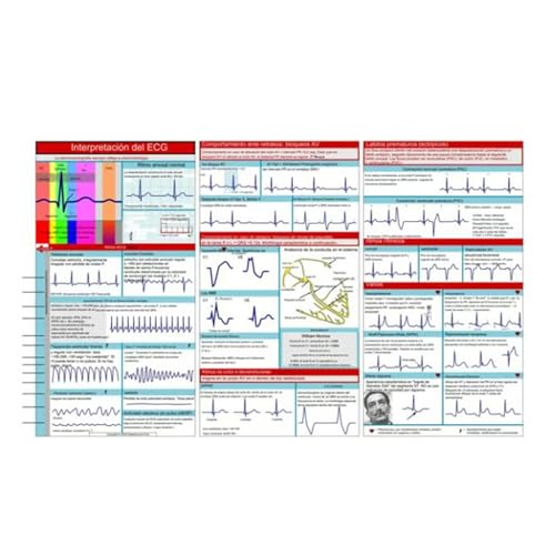 EKG-Taschenhandbuch, EK-Interpretations-Taschenkarte, Doppelseitige Dreifach Gefaltete Elektrokardiogrammkarte, Langlebige Kompakte Größe, Leicht Zu Lesen, Kompaktes Und Tragbares Referenzhandbuch von Aceirropy