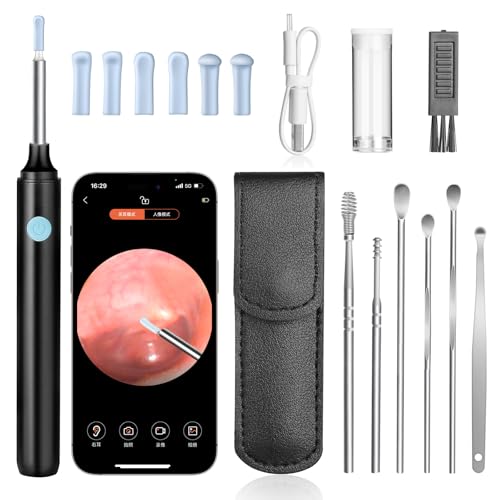 AiQInu Ohrenschmalz Entferner Otoskop, 1080P HD-Otoskop, Wifi Ohrreiniger mit kamera, Otoskop mit 6 LEDs, Wasserdicht Otoskop Ohr, für iPhone, Android, iPad, Schwarz von AiQInu