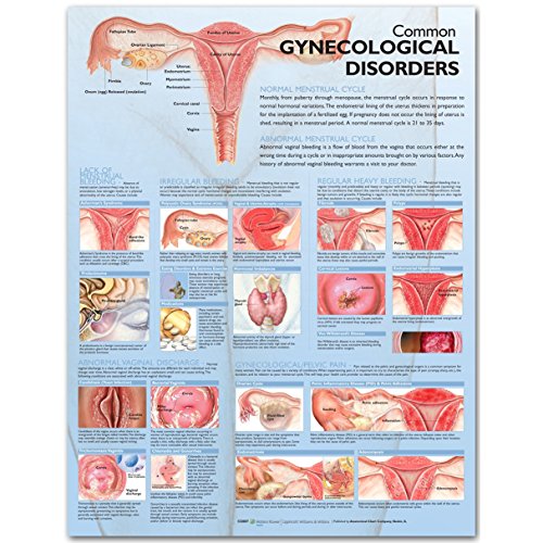 Common Gynecological Disorders Anatomical Chart von Anatomy Stuff