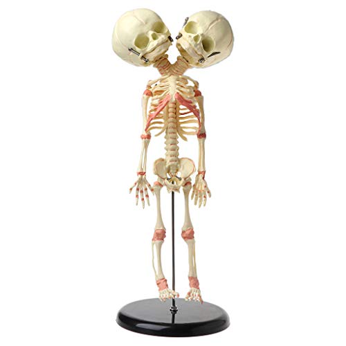 37 Cm Menschliches Doppel Für Babyschädel Skelett Anatomie Gehirnausstellung Studie Unterricht von Chevnzev
