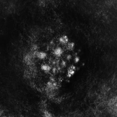 Synedoche von DENOVALI