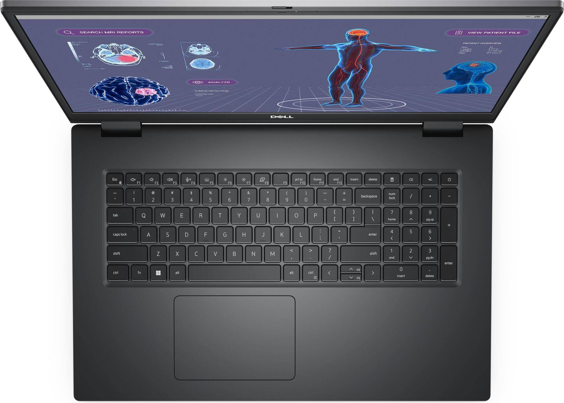 Dell Precision 7780 - Intel Core i9 13950HX / 2.2 GHz - Win 11 Pro - NVIDIA RTX 3500 Ada - 32 GB RAM - 1 TB SSD NVMe, Class 40 - 43.2 cm (17) 1920 x 1080 (Full HD) - 802.11a/b/g/n/ac/ax (Wi-Fi 6E) - Grau - kbd: Deutsch - BTP - mit 3 Jahre Dell ProSupport von Dell