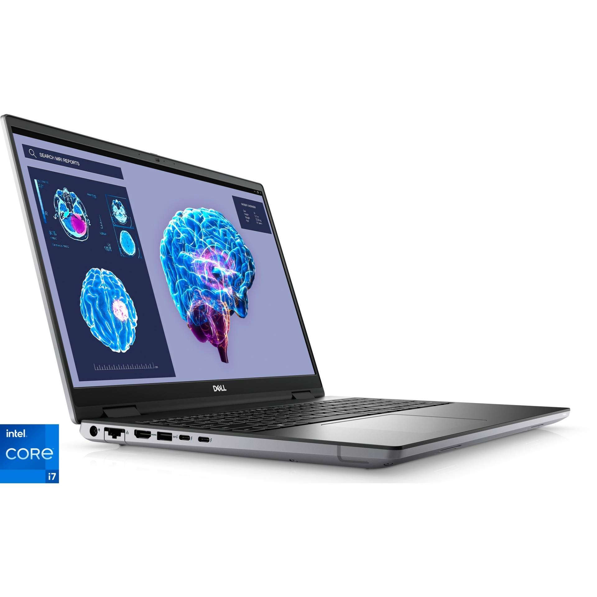 Precision 7680-MKXTJ, Notebook Precision 7680-MKXTJ, Notebook von Dell