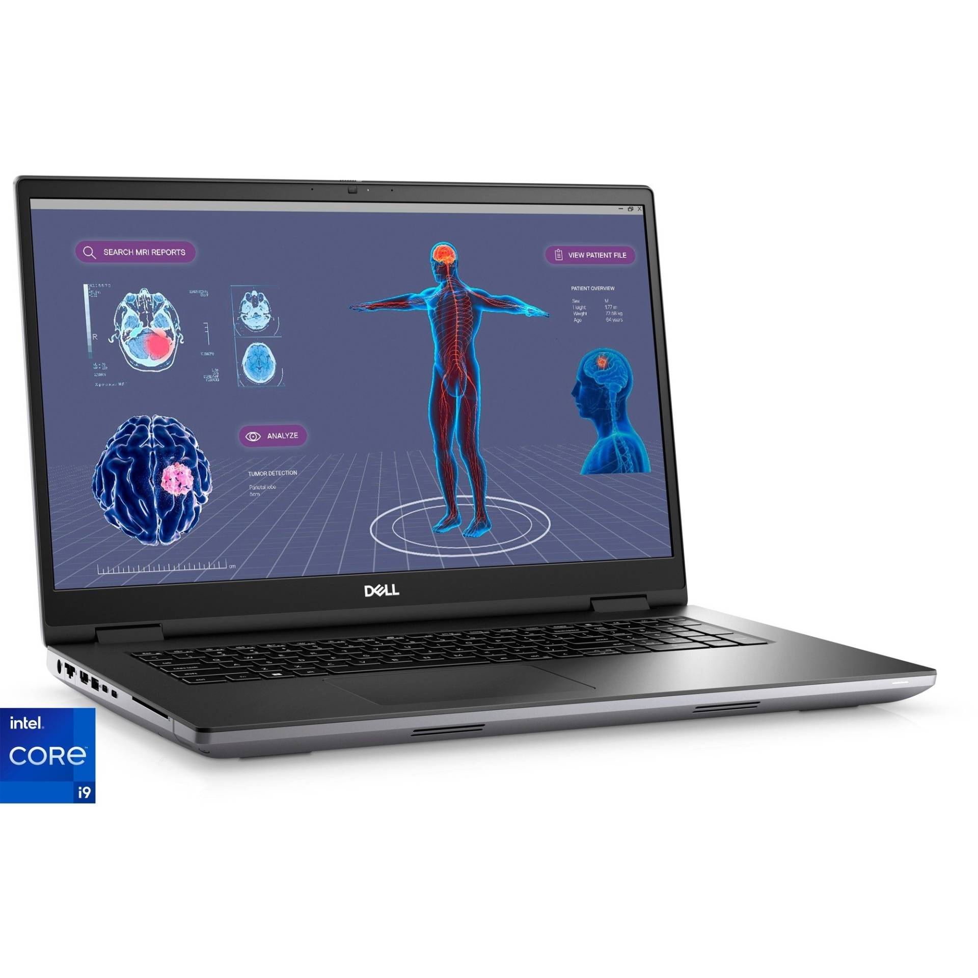 Precision 7780-M6HGP, Notebook Precision 7780-M6HGP, Notebook von Dell