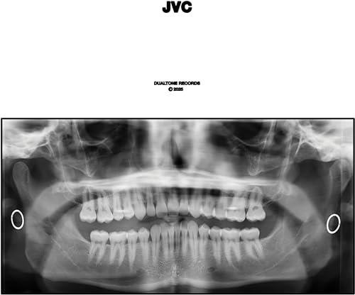 Jvc von Dualtone (H'Art)
