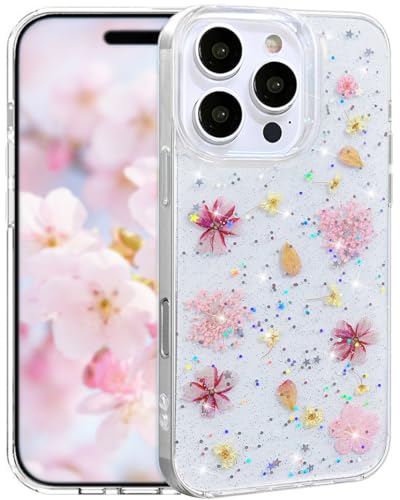 Efitoo Schutzhülle für iPhone 16 Pro, transparent, Glitzer mit Blumen-Design, echt, getrocknet, gepresst, Blumenmuster, Kirschblüte, niedlich, weich, schlank, ästhetisch, stoßfest, für Damen, Mädchen Efitoo Schutzhülle für iPhone 16 Pro, transparent, Glitzer mit Blumen-Design, echt, getrocknet, gepresst, Blumenmuster, Kirschblüte, niedlich, weich, schlank, ästhetisch, stoßfest, für Damen, Mädchen von Efitoo