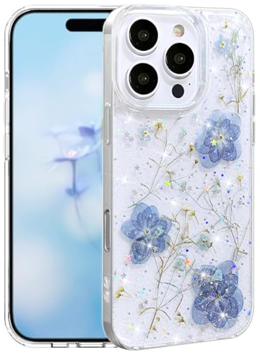 Efitoo Schutzhülle für iPhone 16 Pro, transparent, Glitzer mit Blumen-Design, echte getrocknete gepresste Blume/Blumenmuster, niedlich, weich, schlank, ästhetisch, stoßfest, für Damen und Mädchen Efitoo Schutzhülle für iPhone 16 Pro, transparent, Glitzer mit Blumen-Design, echte getrocknete gepresste Blume/Blumenmuster, niedlich, weich, schlank, ästhetisch, stoßfest, für Damen und Mädchen von Efitoo