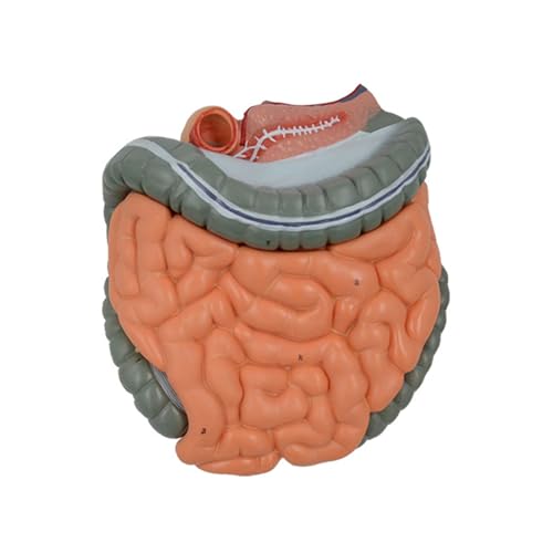 Anatomie Modell Des Menschlichen Verdauungssystems Für Krankheiten Untersuchen Großer Darm Und Cecum Anatomiemodell Mit Zurückhaltbaren Teilen von GADAW