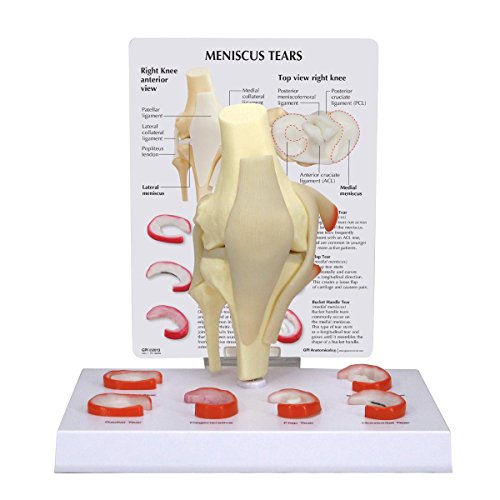 GPI Anatomicals 1010 Meniskus-Kniemodell mit 6 Rissen GPI Anatomicals 1010 Meniskus-Kniemodell mit 6 Rissen von 3B Scientific