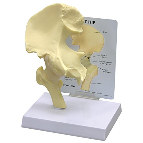 GPI Anatomicals 1260 Einfaches Hüftmodell von 3B Scientific