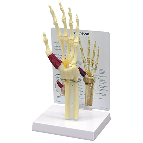 GPI Anatomicals 1920 Hand ModellKarpaltunnelsyndrom GPI Anatomicals 1920 Hand ModellKarpaltunnelsyndrom von 3B Scientific