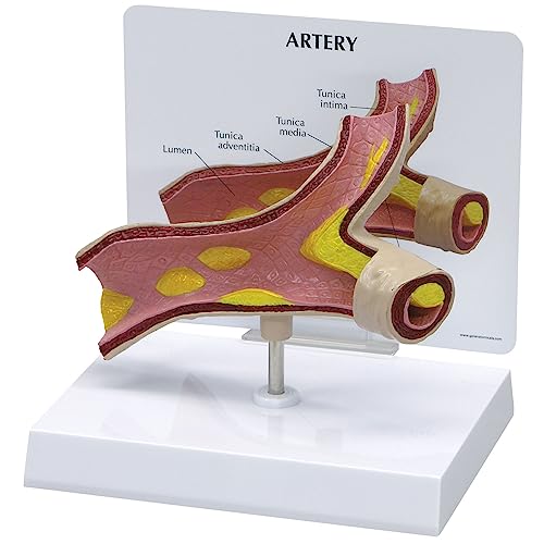 GPI Anatomicals 2600 Arterie Modell GPI Anatomicals 2600 Arterie Modell von 3B Scientific